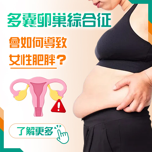 70789120.jpg 多囊卵巢55.jpg